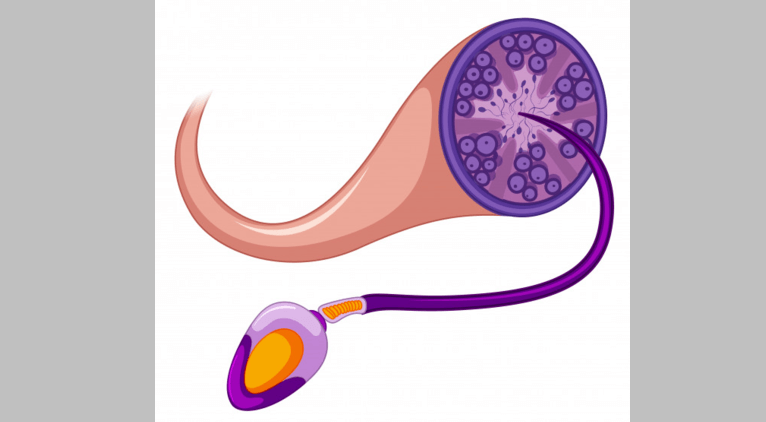 Semen Analysis in Thane - Semen Analysis - Everything about sperm & infertility (Part 1)